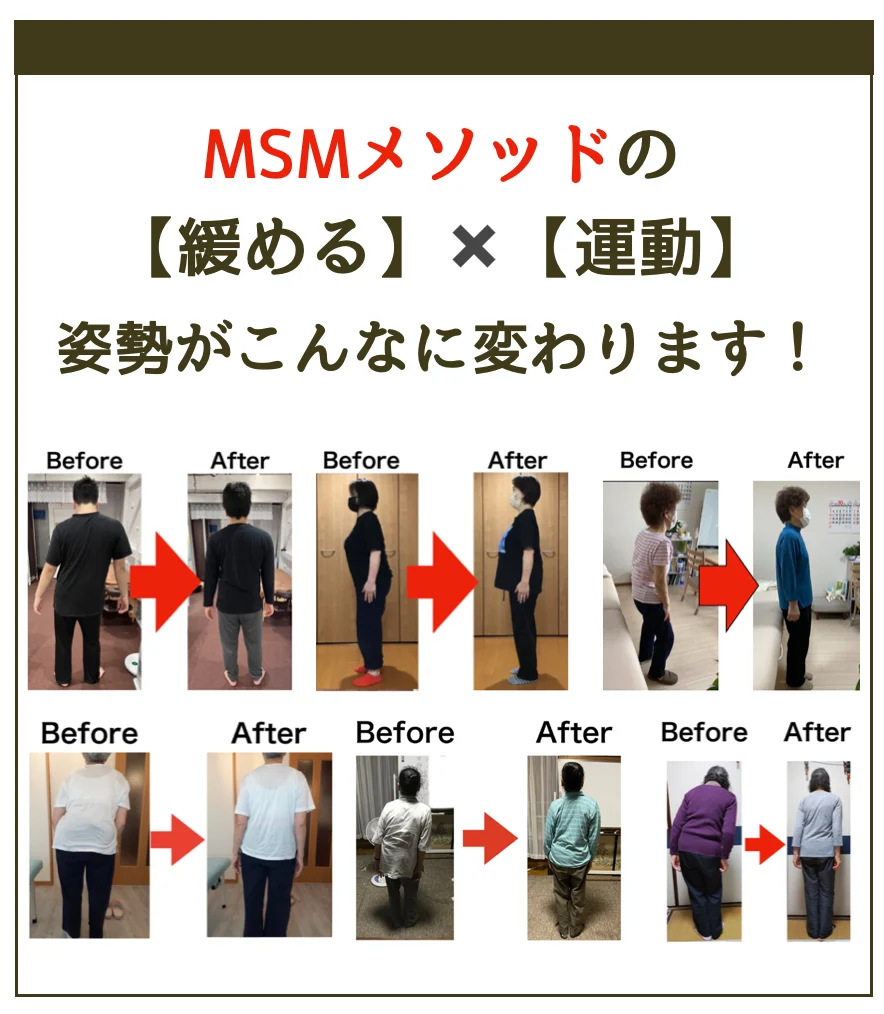 MSMメソッド 姿勢の変化 Before After